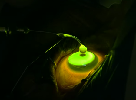 aplicación de rivoflabina vitamina B2 en crosslinking
