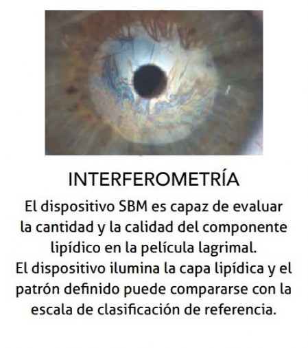 Interferometría de la lágrima Interferometría de la lágrima