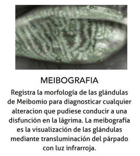 Meibografia Análisis Glándulas Meibomio
