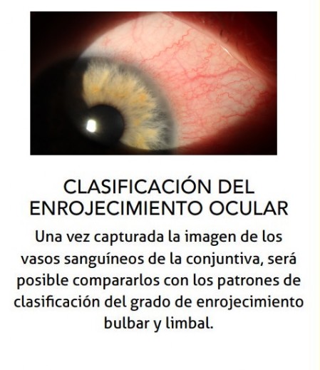 Enrojecimiento ocular