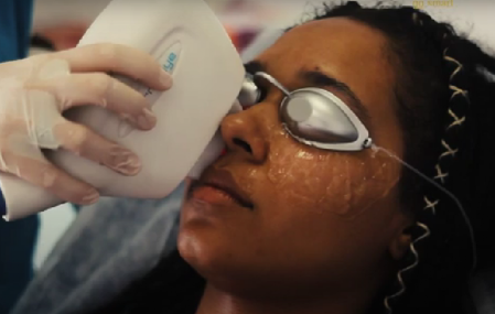 thermaeye thermaeye